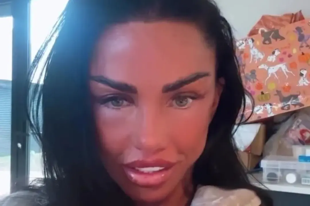 Katie Price, com 48 anos, apareceu com rosto inchado e olhos pretos após mais uma cirurgia. O visual dela não combina c…