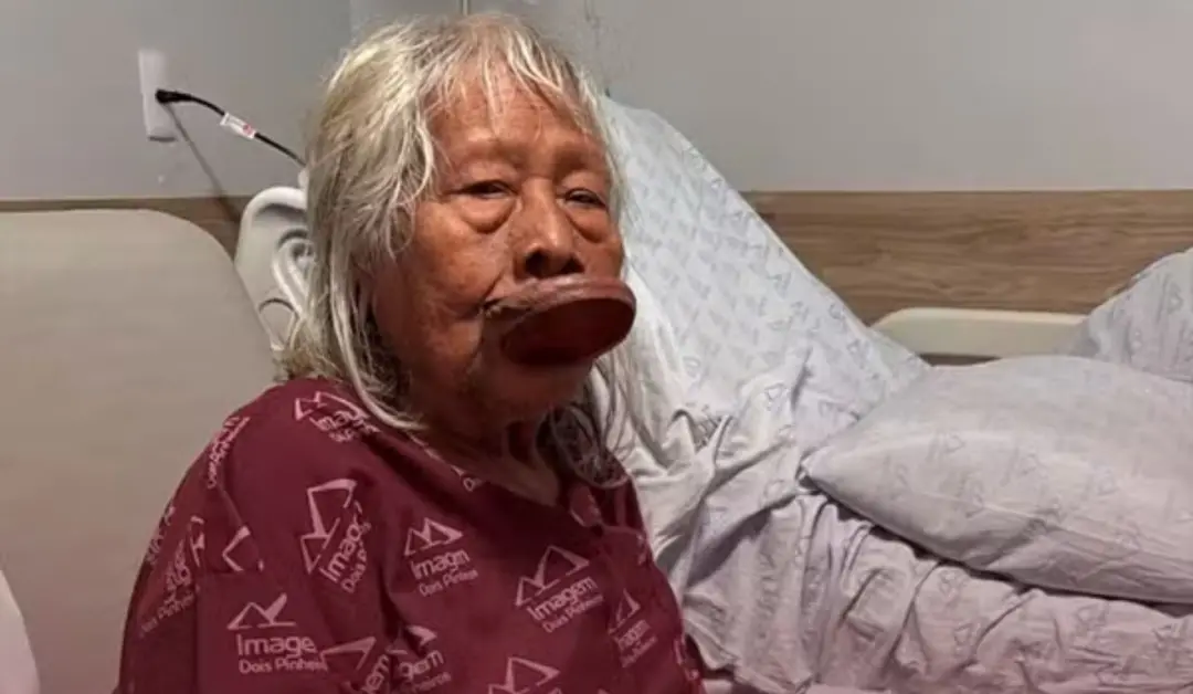 Cacique Raoni Metuktire foi diagnosticado com câncer no aparelho digestivo aos 94 anos, em Peixoto de Azevedo, no norte…