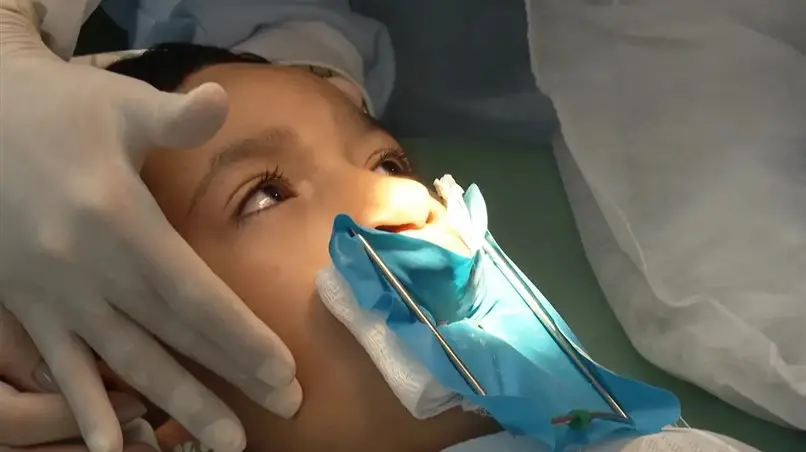 Alerj aprovou a Lei 11.313/26, que garante tratamento pós-cirúrgico para fissura labiopalatal em recém-nascidos. A incl…
