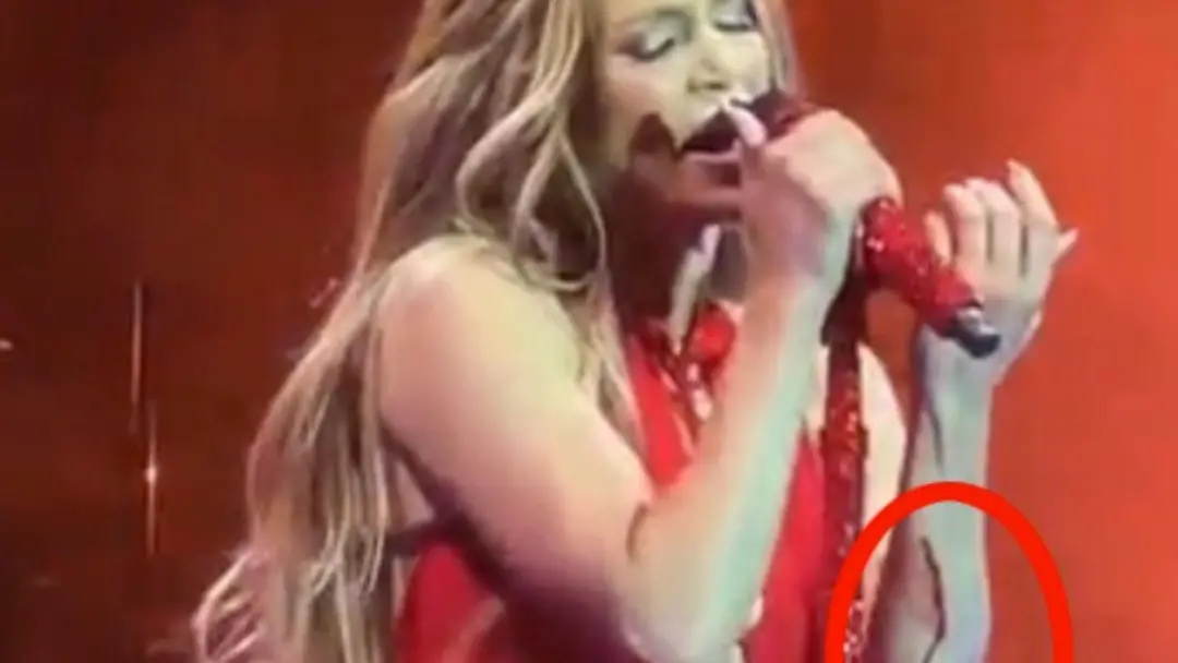 Jennifer Lopez levou um corte feio no antebraço durante a apresentação de Ain't It Funny no tour Up All Night. Ela segu…