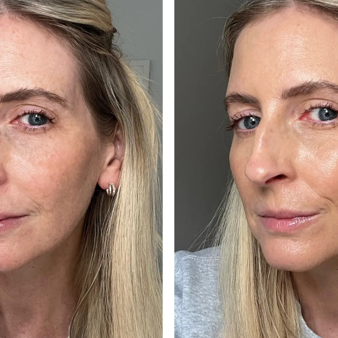 Charley Williams-Howitt, editora de beleza, descobriu o skin tint da Trinny London como uma mudança essencial para a me…