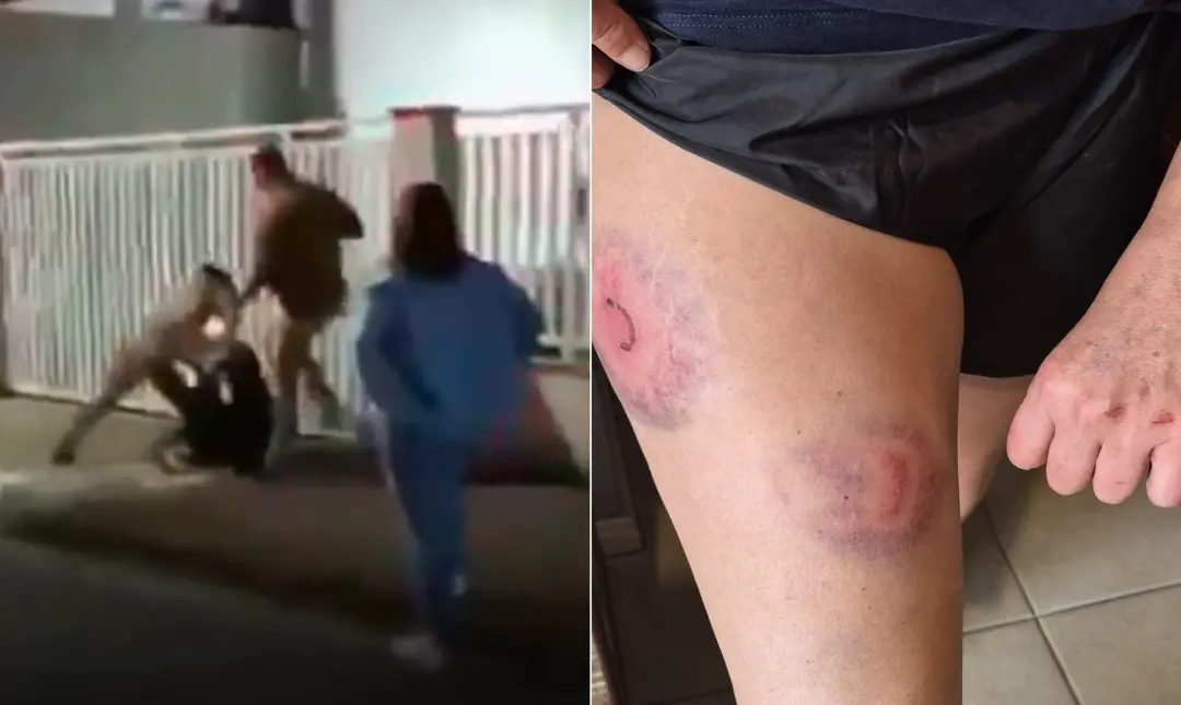 Jaraguá do Sul, em Santa Catarina, gerou polêmica com moção de aplausos para policiais envolvidos em ocorrência com Fer…