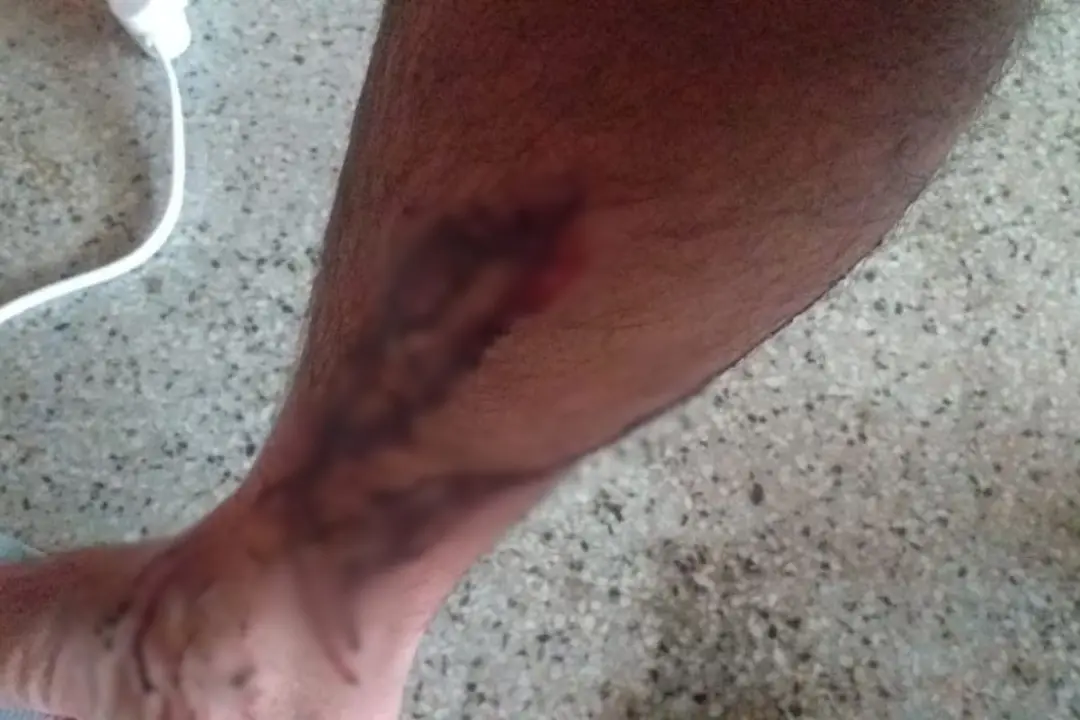 UFRPE condenada a pagar dez mil reais por dano moral a estudante atacado por cães no campus em Serra Talhada. É preocup…
