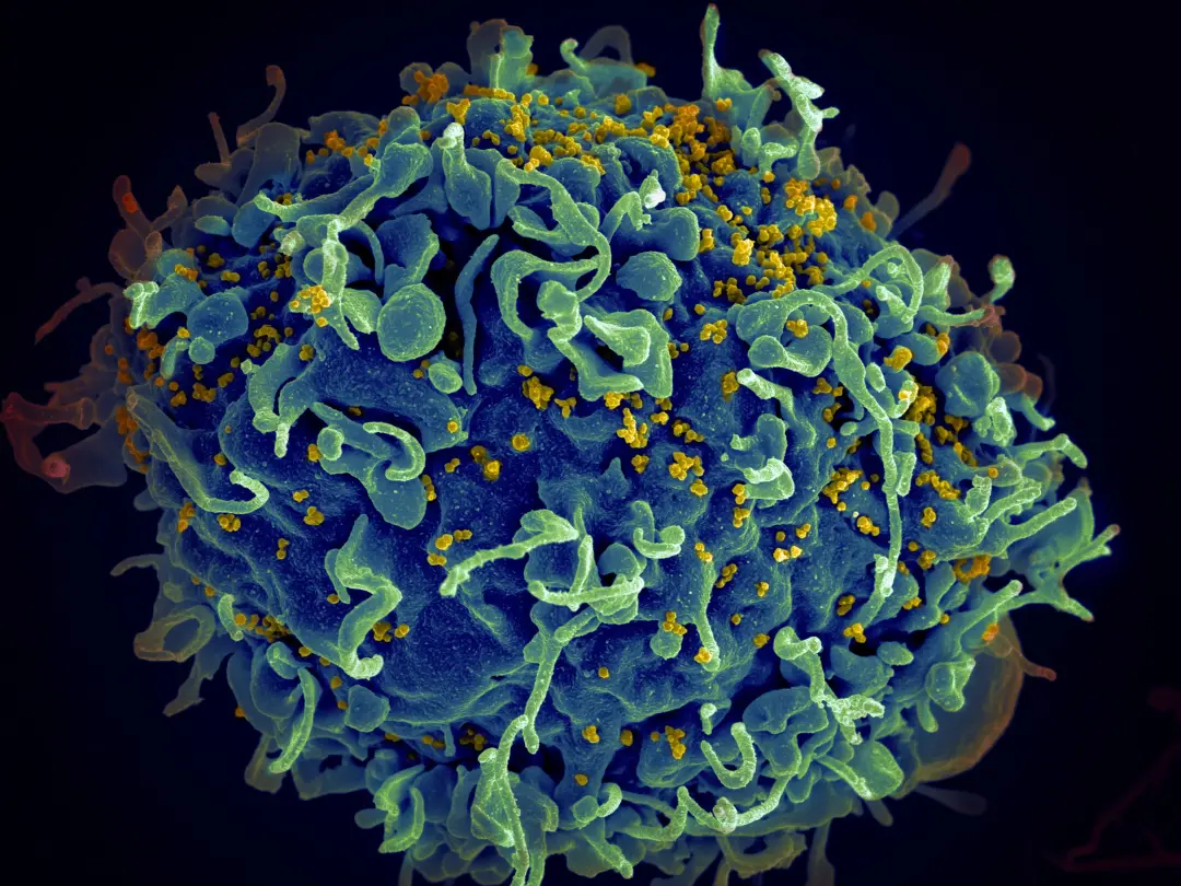 Fiji declara emergência nacional porque os casos de HIV subiram 16 vezes em seis anos, chegando a 2.106 novos diagnósti…