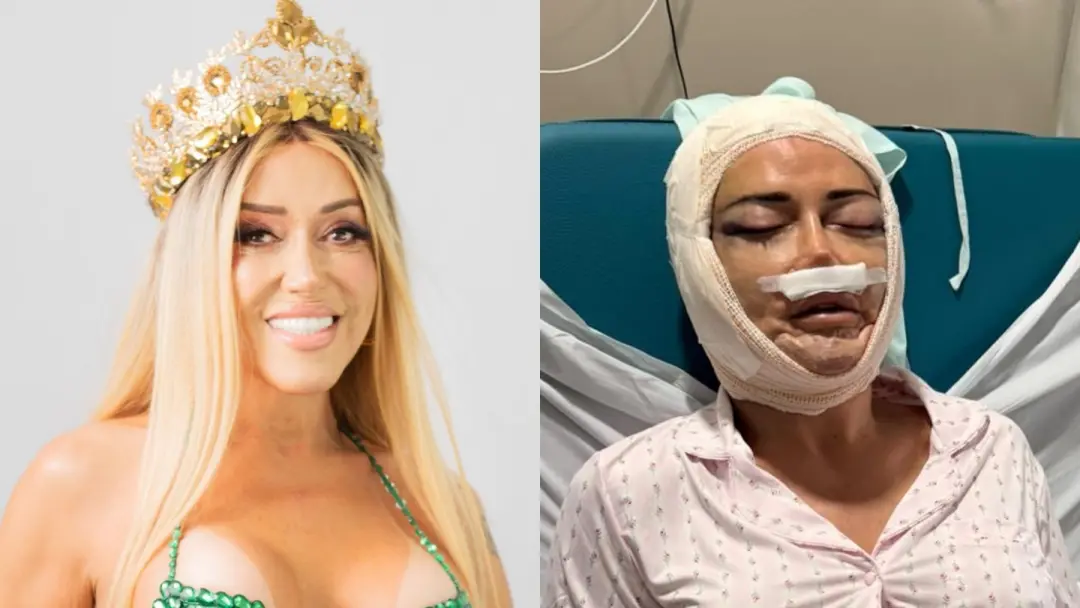Marcela Porto fez um lifting e feminização facial aos 53 anos. A decisão dela não é sobre apagar a idade, mas sobre se …
