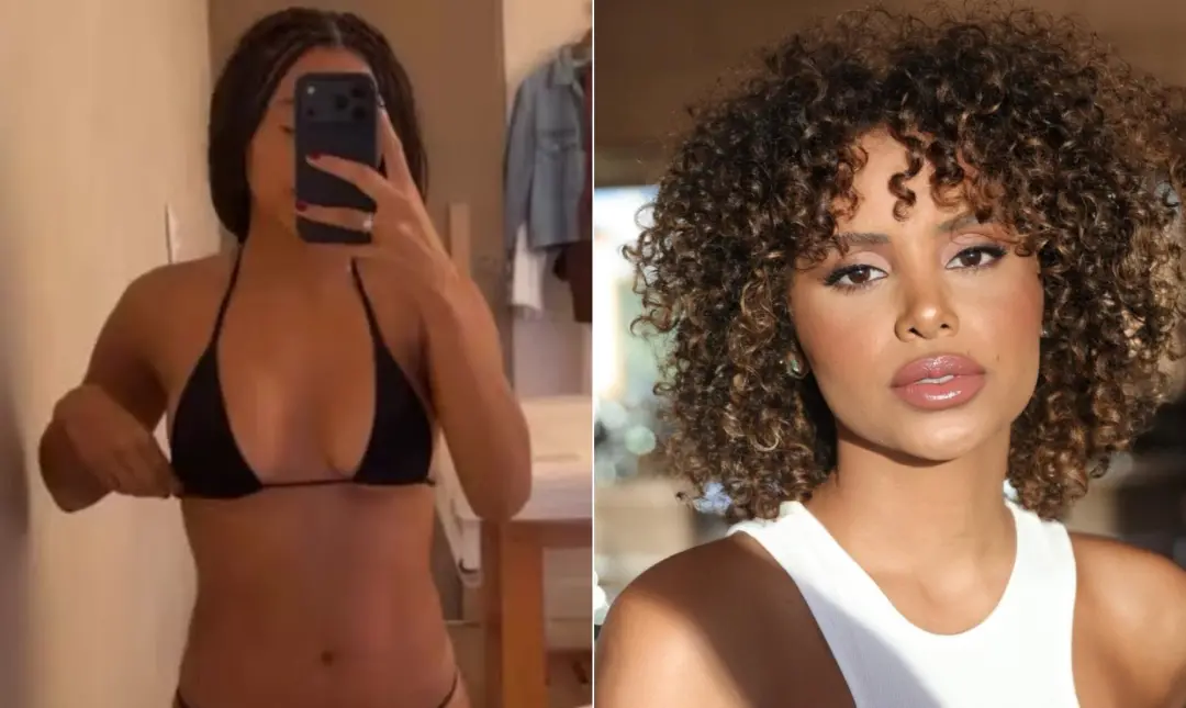 Gleici Damasceno mostrou fotos do corpo após fazer lipocavitação na região abdominal. O procedimento usa ondas ultrassô…