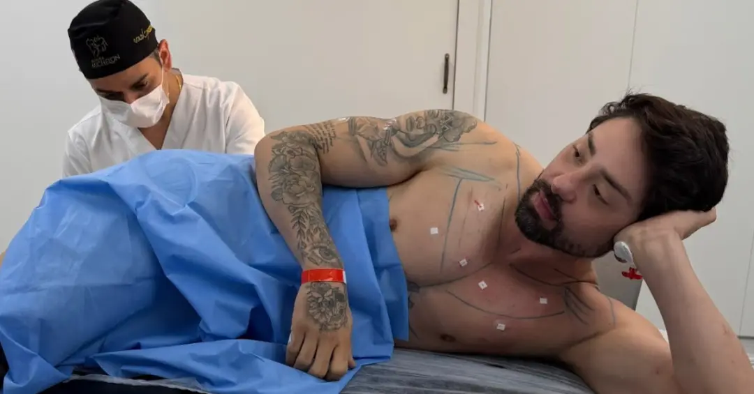 Rico Melquiades fez procedimentos estéticos incluindo o Cutox na região anal para evitar odor. A intenção dele é manter…
