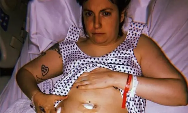 Lena Dunham, aos 40 anos, finalmente deu as boas-vindas a um bebê por barriga de aluguel depois de anos de luta contra …