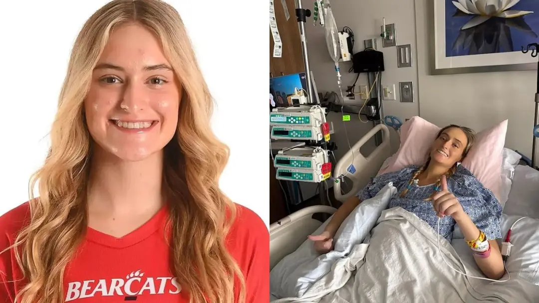 Amanda Mack, jogadora de vôlei nos EUA, faleceu aos 20 anos semanas após ser diagnosticada com anemia aplásica grave. A…