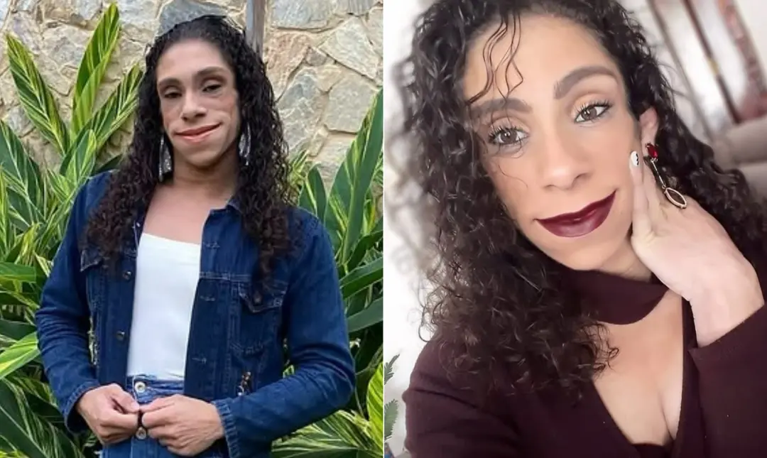 Karyn Cerqueira, carioca de 29 anos, vive com lipodistrofia congênita generalizada, doença que causa ausência de gordur…