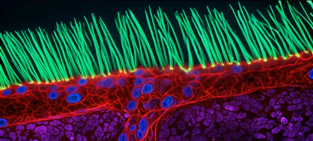 Ning Xu ganhou o prêmio Nikon Small World in Motion por registrar os cílios respiratórios de uma criança com discinesia…