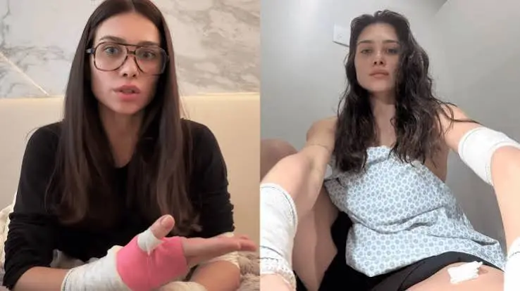 Flavia Pavanelli levou treze pontos após se ferir com o box de vidro durante o banho. Acidente doméstico inesperado, qu…