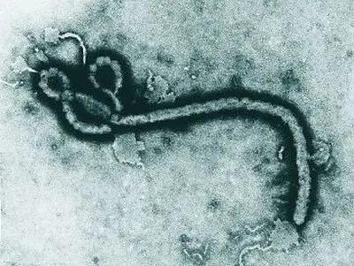 RDC inicia testes com vacina contra ebola em 20 mil trabalhadores na Ituri e Kivu do Norte. É importante tentar um trat…