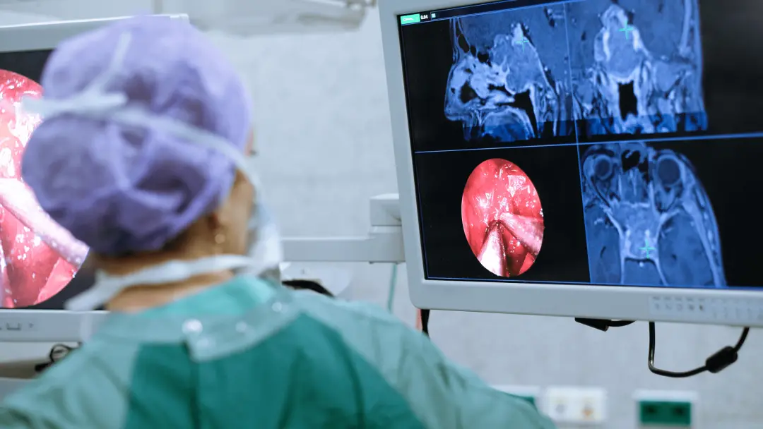 Beaux, após cirurgia por STEMI, apresentou recuperação notável ao levantar os dedos. A capacidade de resposta do pacien…