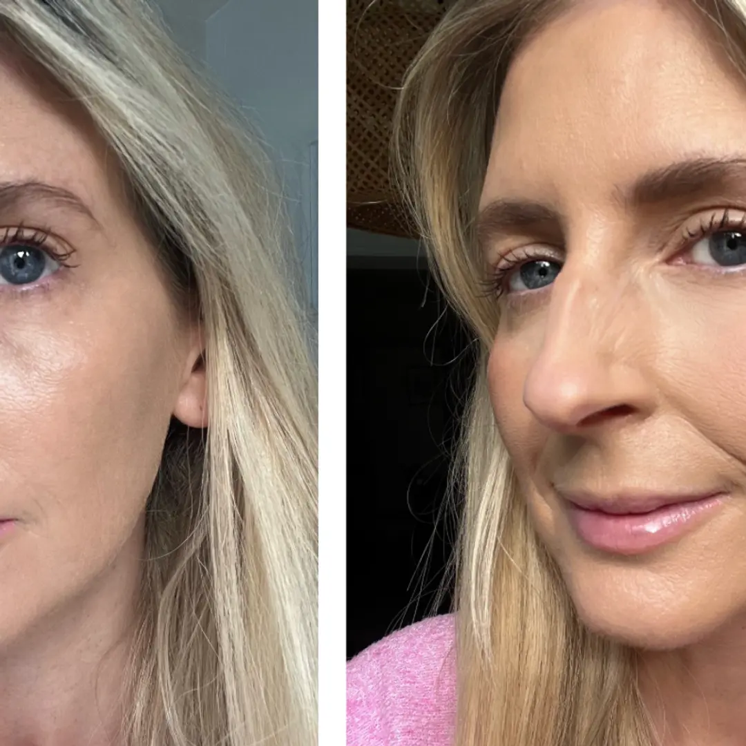 Concealer sob os olhos pode sim deixar mais cansada, esse é o fato. Usar errado pode acentuar a aparência de cansaço, e…