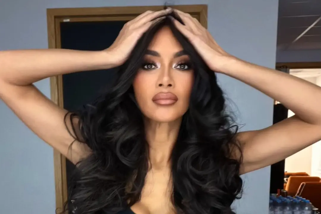 Nicole Scherzinger mostrou fotos de lesão na perna depois de água fervente espirrar nela antes de subir ao palco em Ale…
