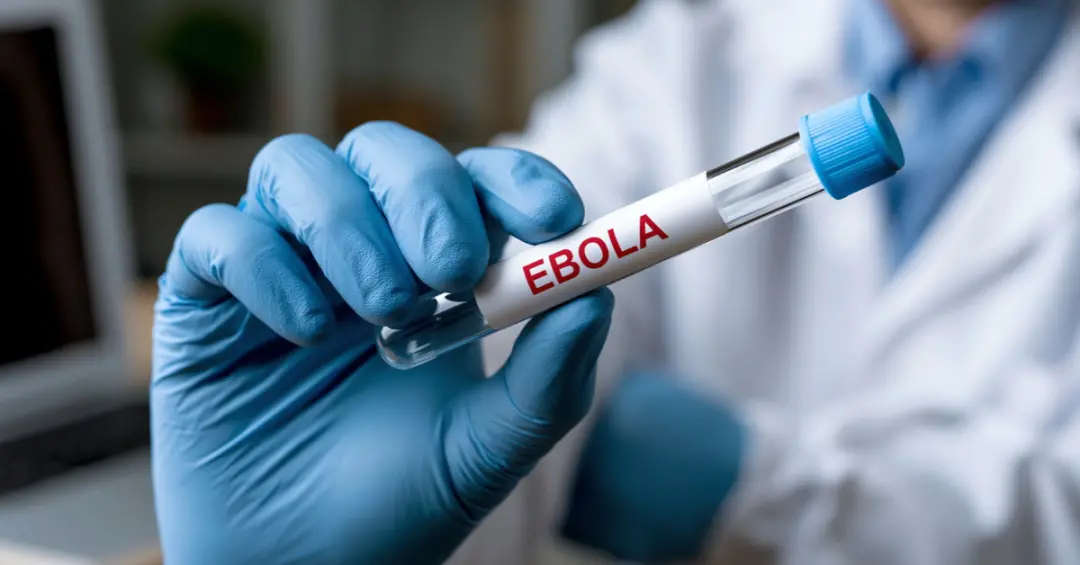 Quênia confirma o primeiro caso de ebola no país, de um homem que vinha da República Democrática do Congo. A situação m…
