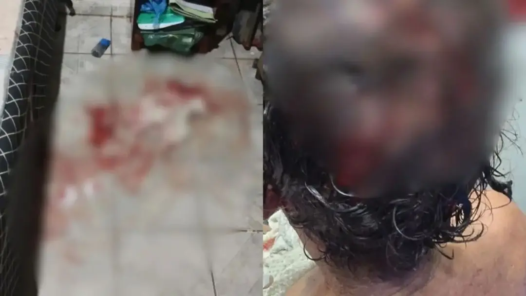 Seis facadas na cabeça de um homem de 47 anos, após discussão, em Goiânia. Situações de violência doméstica mostram um …