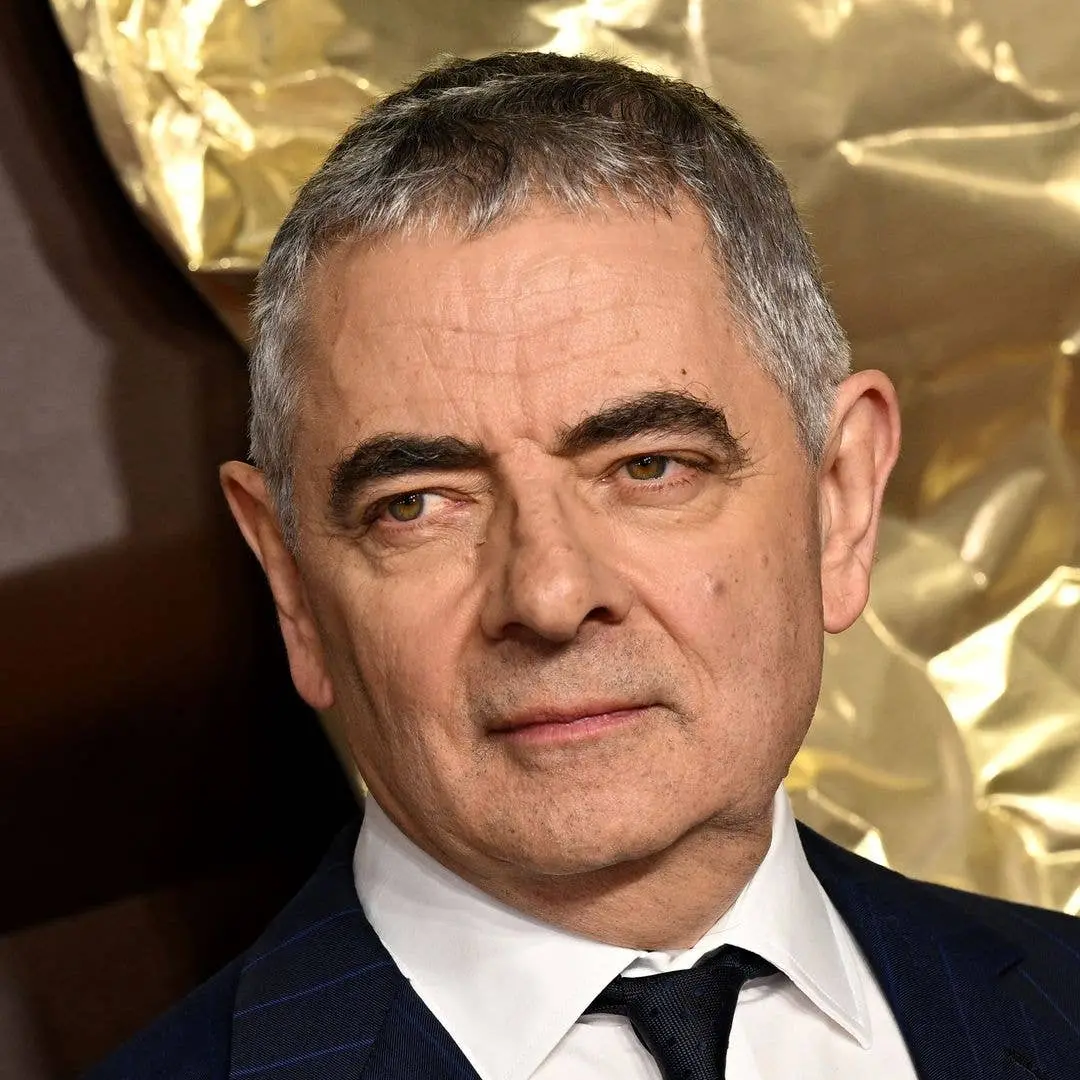 Louise Ford, parceira de Rowan Atkinson, vai estrear em West End no show Rowan Live, 30 anos mais nova. É interessante …