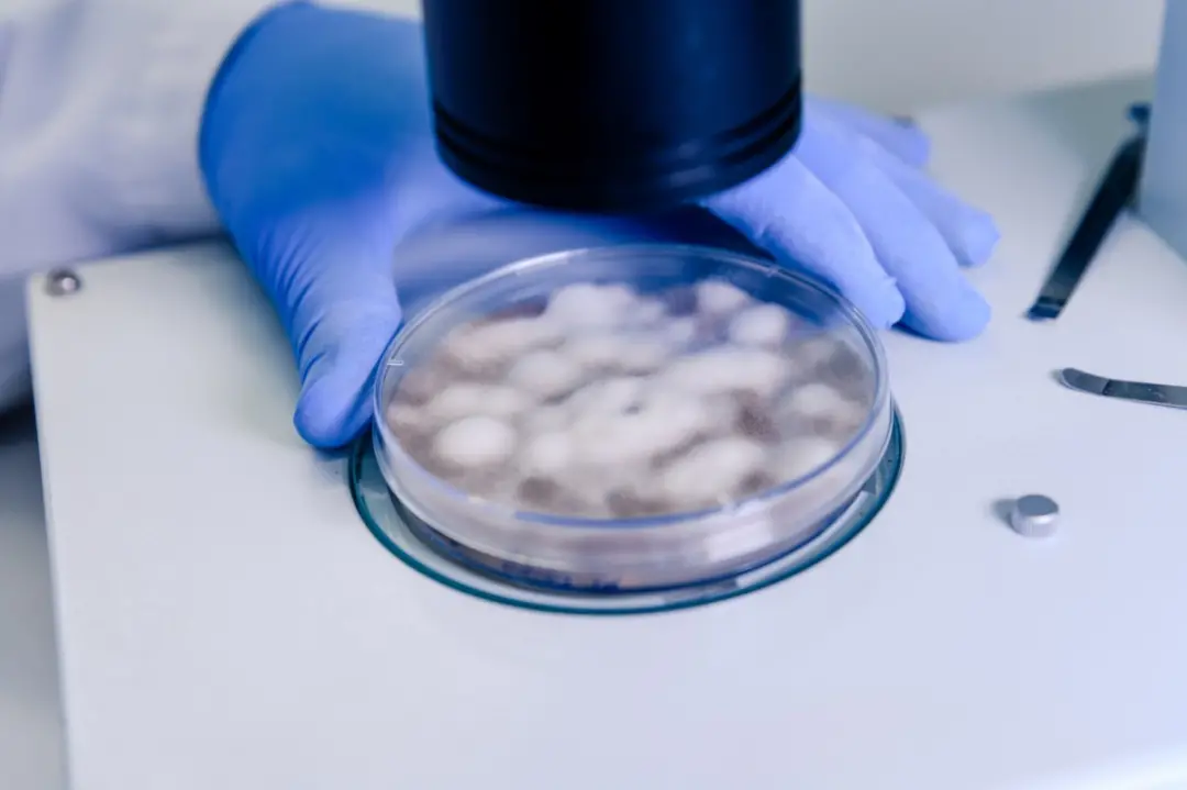 Irkutsk, Sibéria, viu uma técnica de laboratório, Darya Shipilova, morrer de pneumonia enquanto estudava peste. O risco…