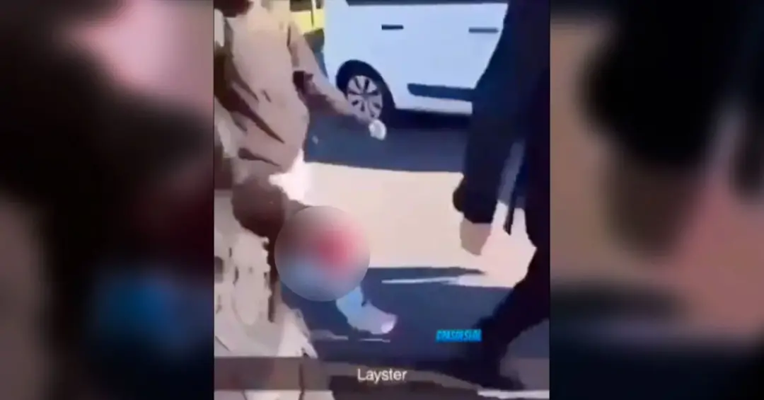 Lens, França. Um estudante de 15 anos perdeu a mão esquerda durante protesto estudantil por falta de recursos nas escol…