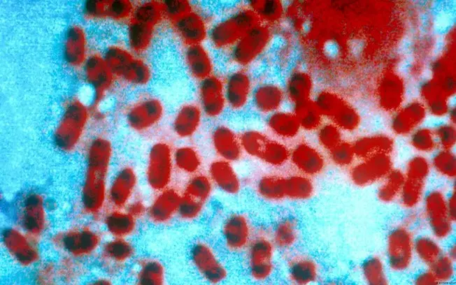 Irkutsk, Sibéria, viu uma pesquisadora de 28 anos morrer por pneumonia de origem desconhecida. As autoridades locais ne…