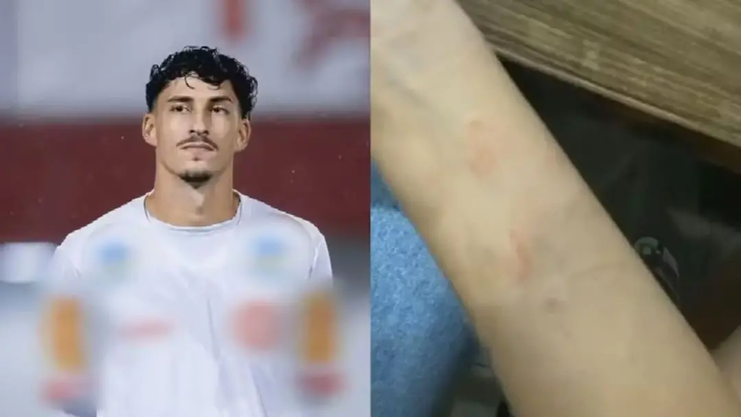 Jogador do Rio Verde foi preso suspeito de agredir namorada durante festa, após discussão por ciúmes. A agressão result…