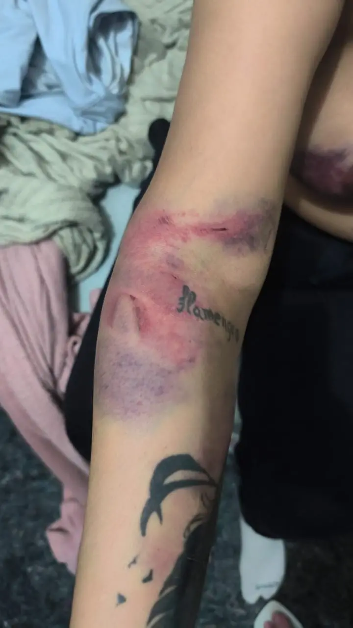 Luiza Carla Coutinho, presa há dois anos, foi agredida brutalmente dentro da Penitenciária Talavera Bruce em Bangu. É f…