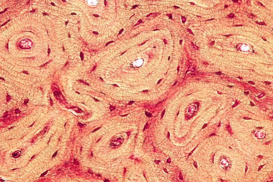 Pressionar ossos da canela melhorou sintomas motores e cognitivos em camundongos e porcos com lesão cerebral traumática…