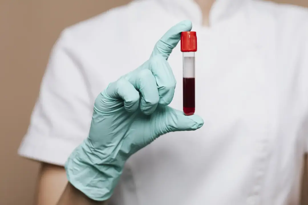 Redução de prazos para doação de sangue e revisão de critérios para quem teve câncer ou problemas na tireoide. A chance…