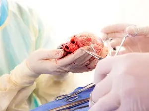 Coração de mais velho parece rejuvenescer ao ser transplantado em corpo mais jovem. Isso me faz pensar na fragilidade d…