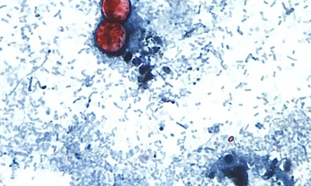 Mexico, Guanajuato. Parasita Cyclospora foi achado em alface de fazenda ligada ao surto de quase 13 mil casos nos EUA. …