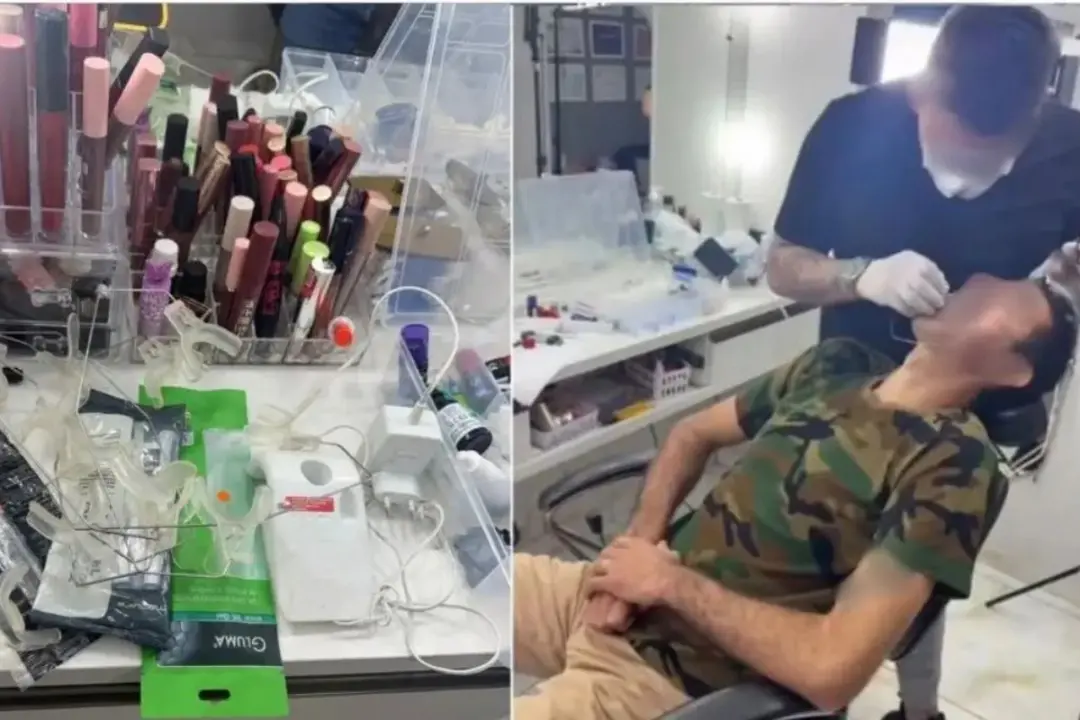 Coronel Sapucaia, MS teve um falso dentista preso por usar salão de beleza como consultório clandestino. Isso mostra a …