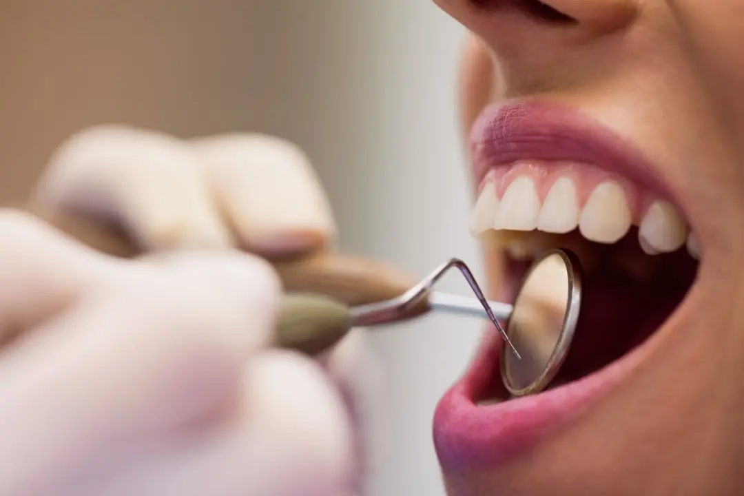 Doença periodontal moderada a grave em 15,3% dos adultos brasileiros de 35 a 44 anos. Um processo inflamatório nos teci…