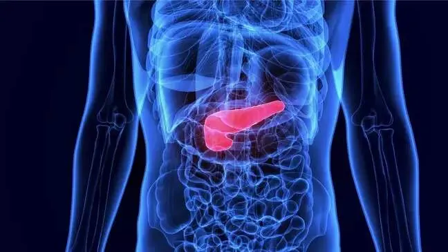 Nos Estados Unidos, a FDA aprovou o daraxonrasib para câncer de pâncreas metastático. Essa aprovação é fundamental porq…