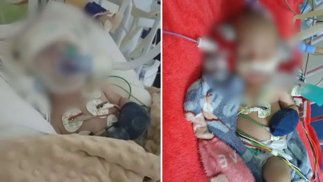 Bebê de três meses continua na UTI em Vitória um mês depois de levar um soco do pai. O menino sofreu traumatismo crania…