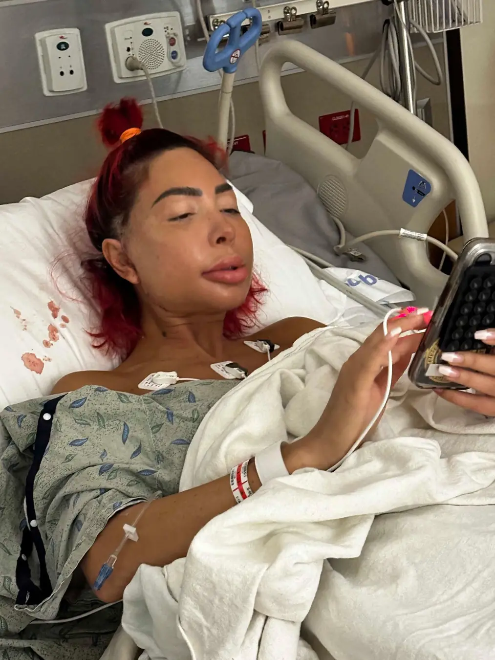 Farrah Abraham fez cirurgia de mandíbula dupla e tá com inchaço intenso. Ela vai passar dois meses sem poder falar ou c…