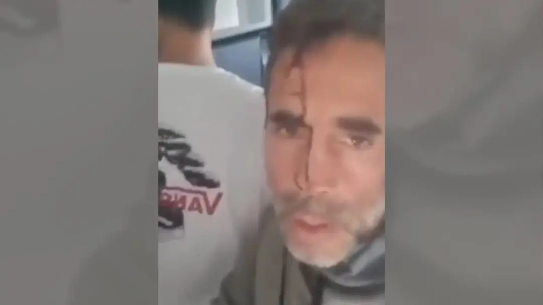 Dubai, voo da Flydubai, teve incidente grave onde o copiloto atacou o piloto e quase derrubou a aeronave. A intervenção…