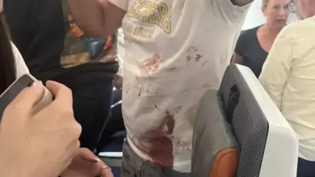 Voo da Flydubai com pouso de emergência na Arábia Saudita, com passageiros e piloto feridos depois de um ataque. O copi…