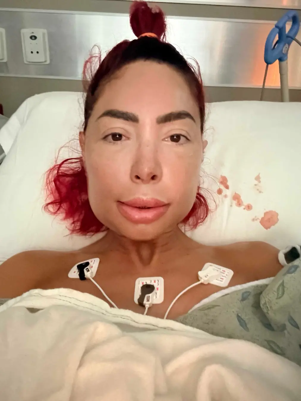 Farrah Abraham, aluna da Teen Mom, passou por cirurgia de mandíbula dupla-disco. O inchaço depois do procedimento chama…