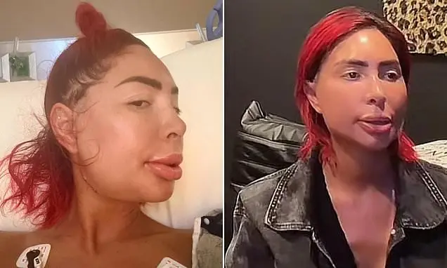 Farrah Abraham, conhecida por cirurgias estéticas extremas, apresentou um rosto visivelmente alterado após um procedime…