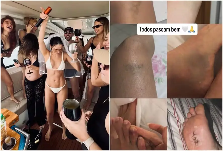 Juliette apareceu com hematomas depois da despedida de solteira na Paraíba, onde um amigo precisou de pontos no pé. Ach…