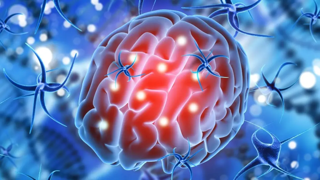 Pausa na atividade neuronal antes de uma crise epiléptica. Pesquisadores descobriram que esse silenciamento serve como …