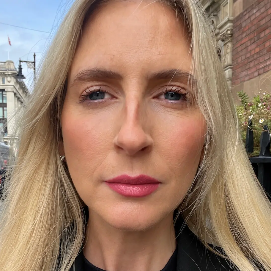 Cupido bow menos definido, uma editora de beleza viu isso acontecer. Um ajuste sutil no preenchimento labial pode devol…