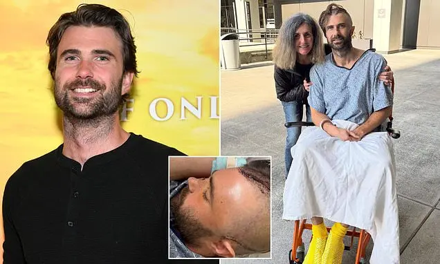 Ator de 32 anos sofreu lesão cerebral traumática depois de ser atingido por carro em Los Angeles. Dirigiu em mais de 10…