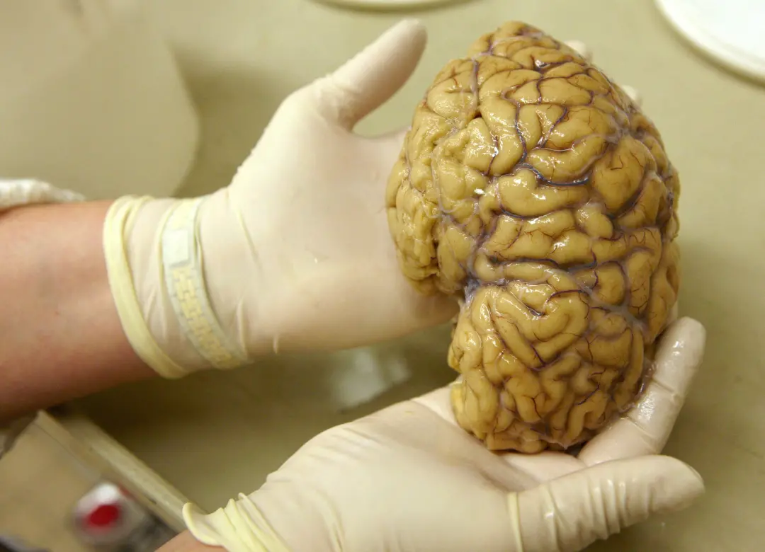 Cientistas mapearam a atividade gênica em mais de 6,3 milhões de células do córtex pré-frontal usando doadores de difer…