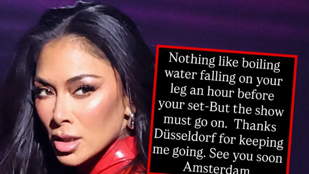 Nicole Scherzinger sofreu uma queimadura enorme na perna depois de água fervente cair nela antes do show da Pussycat Do…