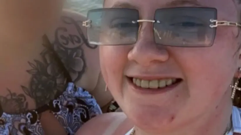 Kayla, de Kentucky, foi parar na unidade de queimados após uma queimadura solar grave durante um passeio de praia em fa…