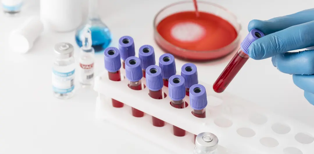 O exame Galleri, capaz de detectar mais de 50 tipos de câncer em sangue, chegou ao Brasil. É um complemento aos exames …