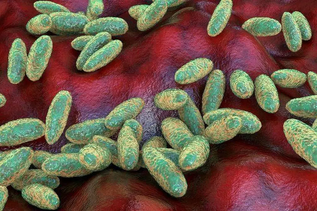 Rússia e OMS, mais informações sobre morte de funcionária de laboratório de peste na Sibéria. O fato de um caso de pest…